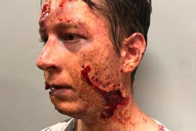 containment-bts-gallery-1 containment-bts-gallery-1